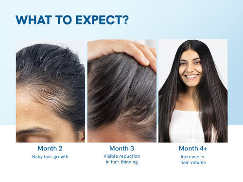 Advanced Hair Growth Roll-On