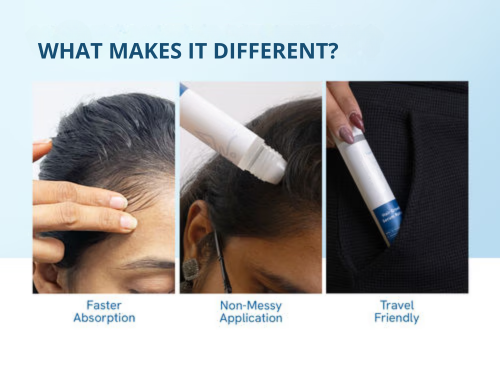 Advanced Hair Growth Roll-On