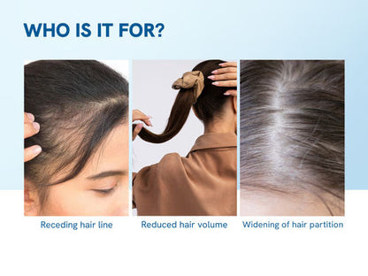 Advanced Hair Growth Roll-On